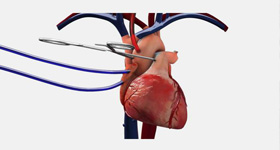 心脏医学动画制作