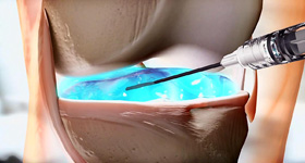 医用医疗器械动画制作