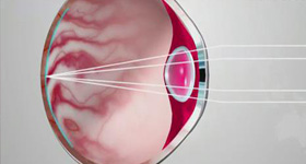 梦戴维 动画制作